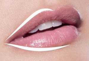 Juvederm Lips