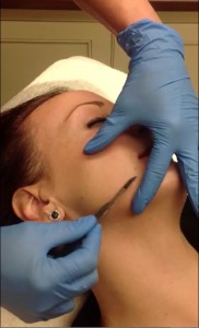 Tonya Dermaplane Thumbnail