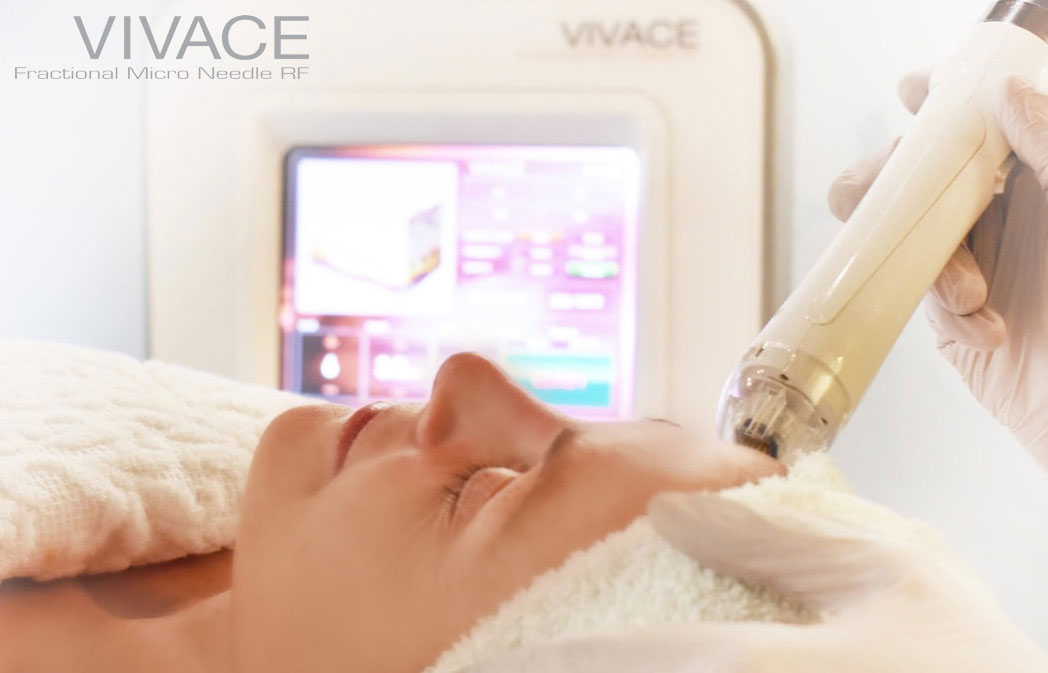 Vivace Micro Needle Picture