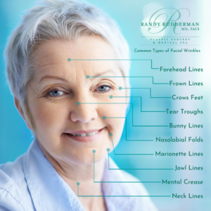 Common Types of Facial Wrinkles