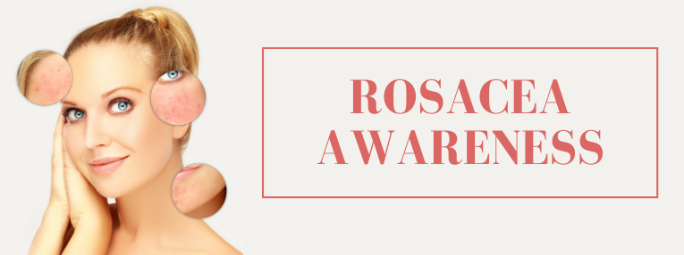 Female Patient With Rosacea Awareness Text