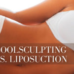 CoolSculpting vs Liposuction Text Overlaid on Female Body