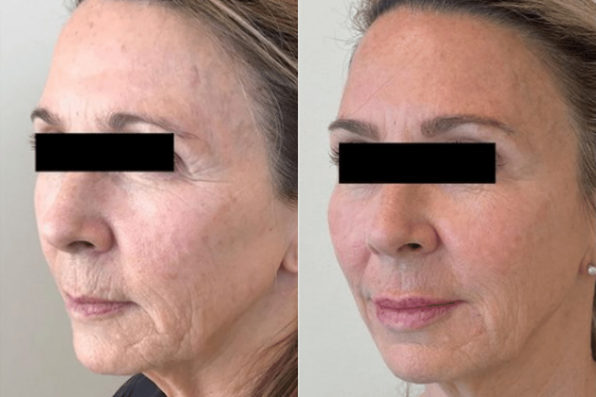 Medical Spa before and after photo