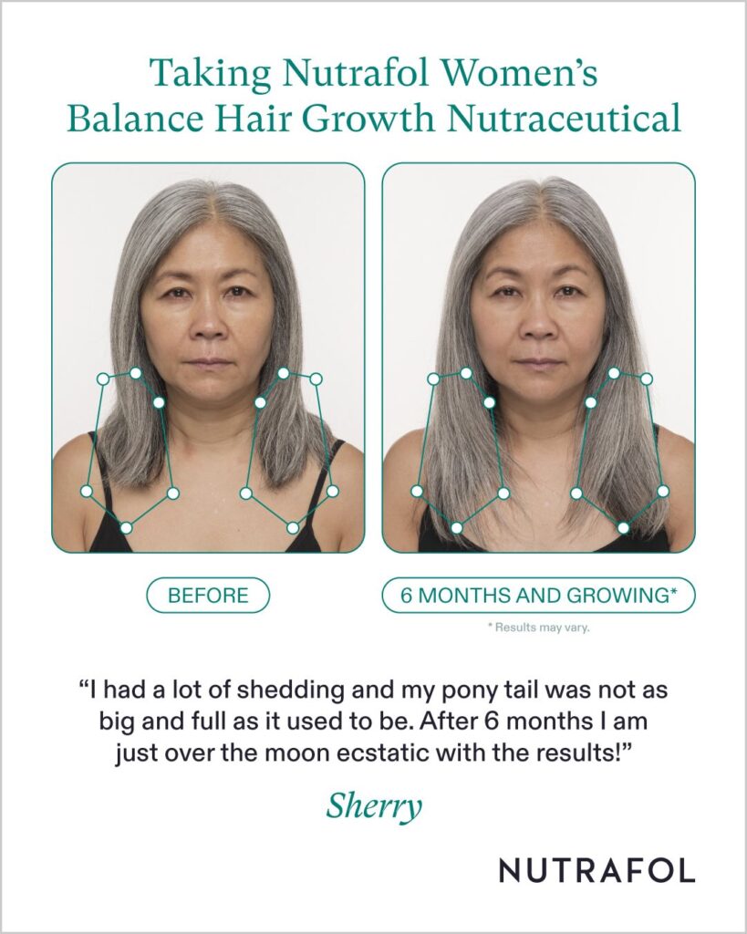 Female Nutrafol Women's Balance before and after