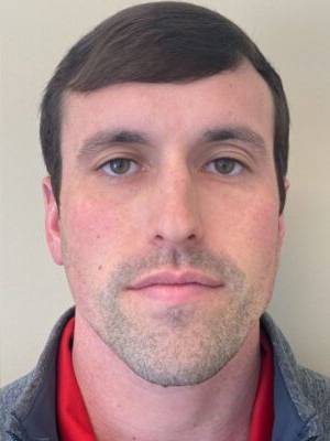 Dermal filler treatment patient photo, front view of the face — Dr. Rudderman, Atlanta.