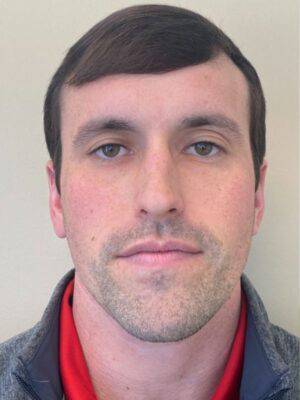 Dermal filler treatment patient photo, front view of the face — Dr. Rudderman, Atlanta.