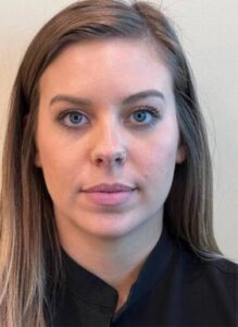 Neuromodulator treatment patient photo, front view of the face — Dr. Rudderman, Atlanta.